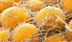 fat_cells_slider